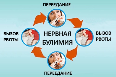 Лечение булимии в Юрге